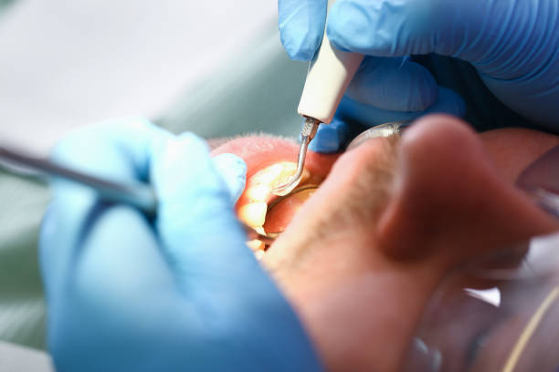 Best Walk-In Emergency Dentist in Sweet Springs, MO