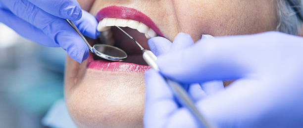 Best Emergency Tooth Extraction in Sweet Springs, MO
